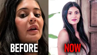 New Leaked Photos Kylie Jenner s Old Face Is BACK After Years Of Filler