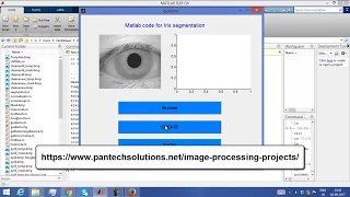 Matlab Code for Iris Segmentation