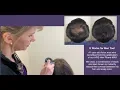 Hair Max Hair Loss Camouflage - Dr Rogers
