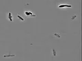 E coli Cells Explode