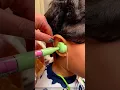 Download Lagu Why is liquid paste filled inside the ears