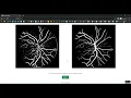Retinal Vessel Image Analysis Jupyter Flask App in Python Projects