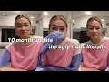 JAW SURGERY regrets