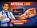 Arterial Line Waveform Explained Placement Normal Waveform Pulse Pressure Variation