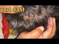 Lagu The Great Lice Battle: Wife Removes Husband's Lice 🐜💇‍♀️ | Part 351\