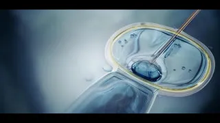 فقه المراة المسلمة د آمال عبد الغني تتناول حكم تحديد جنس الجنين بالوسائل الحديثة 