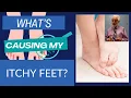 What s Causing My Itchy Feet and How to Treat It