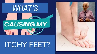 What s Causing My Itchy Feet and How to Treat It