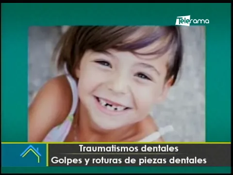 Traumatismos dentales golpes y roturas de piezas dentales