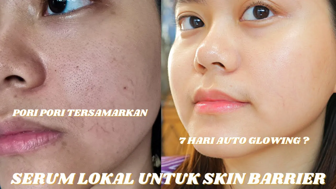 7 Kesalahan Memakai Serum yg Bikin Ga Ngefek dan Merusak Kulit (INI SEBABNYA)