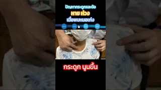  อาการเจ็บหน้าอกที่เกิดจากกระดูกไหปลาร้ามีลักษณะอย่างไร 