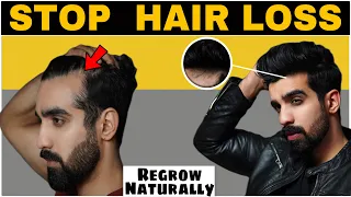Download 7 Ways to STOP HAIR FALL *NATURALLY* REGROW Hair| Hair fall| Hair thinning| Receding hairline MP3
