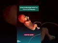 Causes of Miscarriage in the First Trimester of Pregnancy