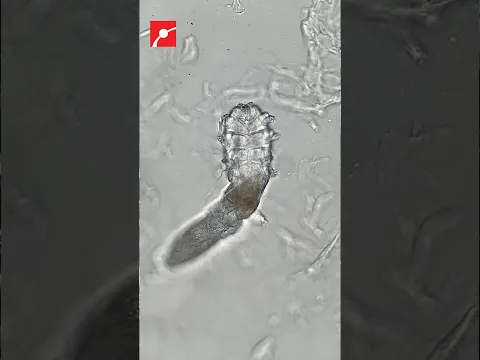 Face Mites Under the Microscope!