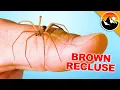 Will it Bite Me Handling a Brown Recluse