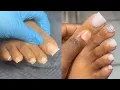 Soft White Acrylic Powder Acrylic Toes For Beginners Acrylic Toes With No Forms Tips