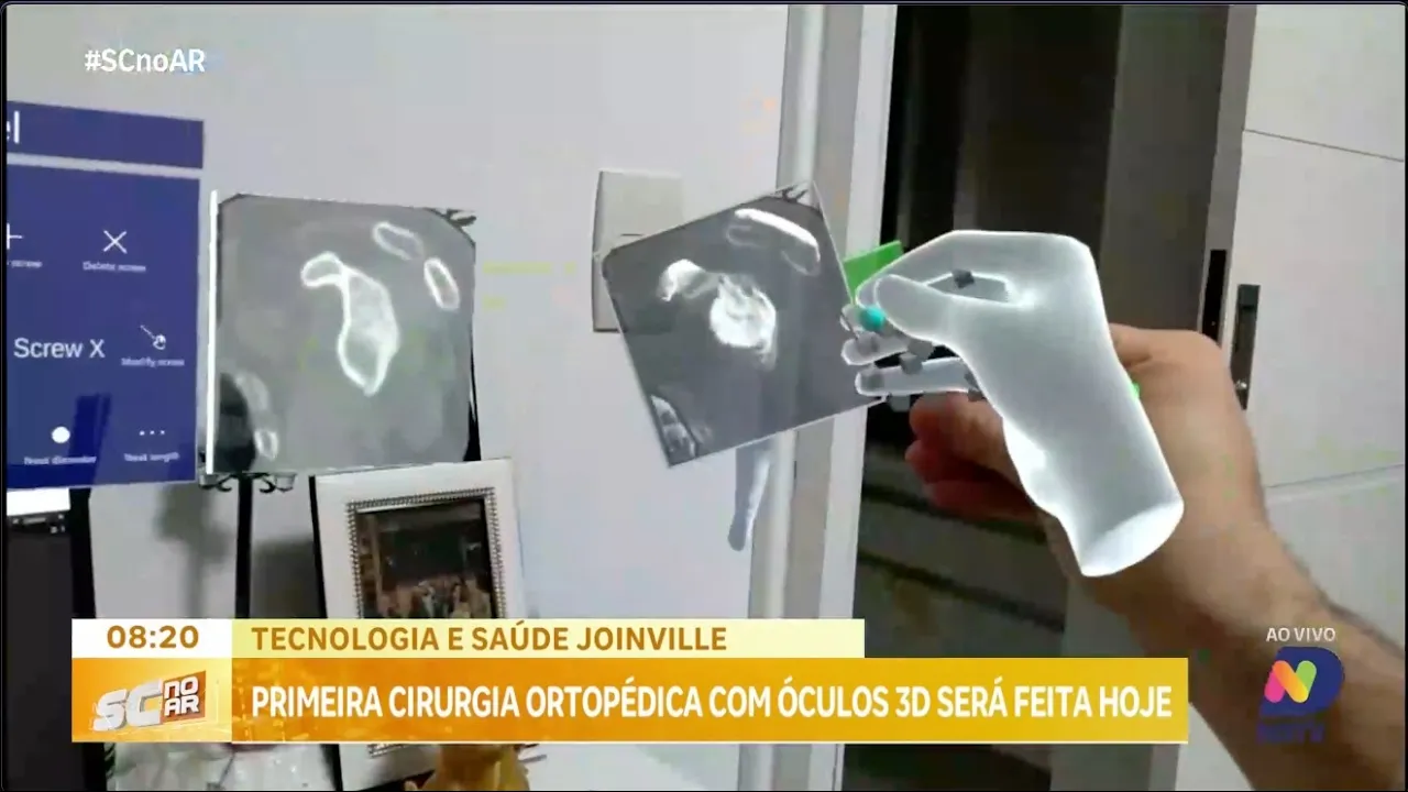 Primeira cirurgia ortopédica com óculos 3D vai ser feita nesta quarta-feira em Joinville