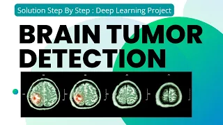 Brain Tumor Detection Using Deep Learning Step By Step Solution Deep Learning Project