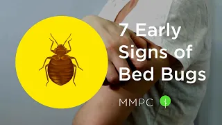 7 Early Signs of BED BUGS How to Know if You Have Bed Bugs