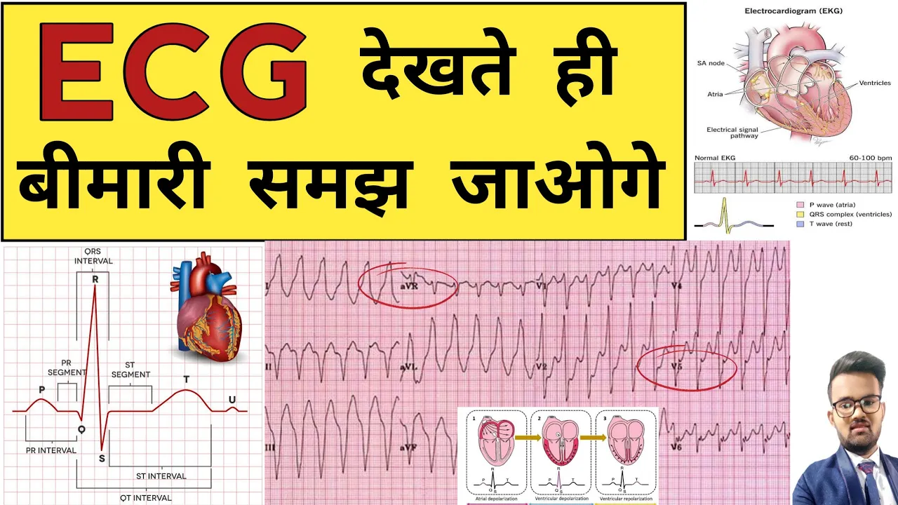ECG Report | ECG Report Reading | ECG Report kaise Pade | Doctor | Hospital | Nursing | BHMS | BAMS