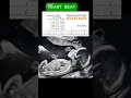 Download Lagu Fetal Heart Rate | Ultrasound #baby #reels #shorts