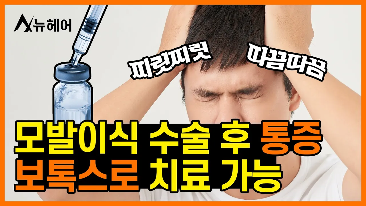 모발이식 부작용 이상감각, 보톡스로 치료 가능!ㅣ뉴헤어