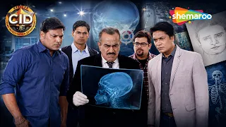 क्या एक X-Ray सुलझा पाएगा CID का ये Mystery Case? | CID | Full HD Episode | 07 Sep 2026
