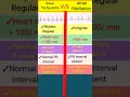 Download Lagu Difference between sinus Tachycardia and Atrial fibrillation ECG l#shorts #ecg