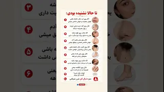 معنی خال روی بدن  واقعیت یا باور قدیمی                          دندنها