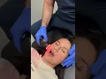 Download Lagu Part 1: Jaw pain? Neck pain? Headaches? You may have TMJ disorder 😱 #kingofcracks #chiropractor