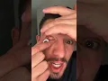 WEARING A GOOGLY EYEBALL