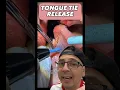 Download Lagu Tongue Tie Release Procedure on Adult | In Office to Hands On Dental Training #shorts