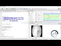 PYTHON 2021 Project - Segmentation and Classification of Diabetic Retinopathy Using Python DIP