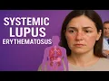 Download Lagu 🦋 Systemic Lupus Erythematosus (SLE) Explained | Symptoms, Causes, Diagnosis \u0026 More