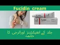 Lagu Fucidin cream uses, side effects and precautions | treats bacterial skin infections | Medical Tips.