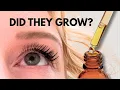 Castor Oil on my Eyelashes for 100 Days - here s what happened