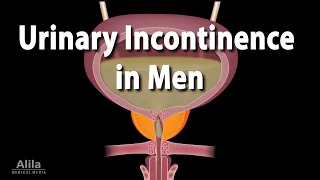 Urinary Incontinence in Men: Types, Causes and Treatment, Animation