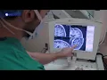 Deep Brain Stimulation Focus on Health KVIE Digital Studios