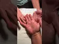 This Hand Massage Makes Anyone Fall Asleep