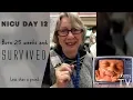 NICU Day 12 Micro Preemie Journey - Mamma and Nanny Smiling Haven TV