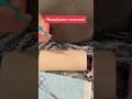 Nexplanon removal