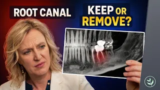 Root Canals Lead to Infection Here s what I d do if I already had one
