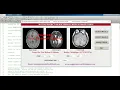 Multimodal Image Fusion Using Matlab Project With Source Code Multimodal Image Fusion Matlab Code