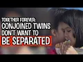 Conjoined Twins Sisters Learn To Live In Harmony