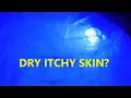 Why Do Hot Tubs Make You Itchy
