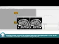 MeVisLab Tutorials - Image Processing