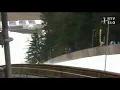 HOLD MY FEEDING TUBE AFTER I SKI JUMP WITH MY FACE