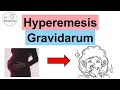 Hyperemesis Gravidarum Pregnancy Nausea Risks Symptoms Complications Diagnosis Treatment