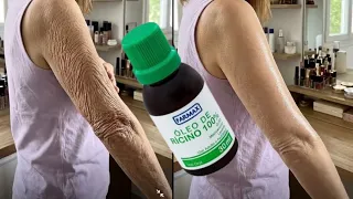 FIZ PLÁSTICA EM CASA SÓ MISTURANDO ISSO A NOITE! 