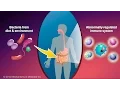 Download Lagu What is Crohn's Disease?